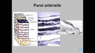 Athérosclérose Anatomie Pathologique Partie 1 [upl. by Phio326]