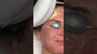 ASMR Laser Treatment [upl. by Aryamo]