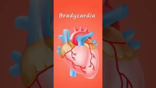 bradycardia biology science [upl. by Hermosa978]