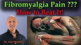 Fibromyalgia Pain How To Beat It  Dr Mandell [upl. by Craggy]