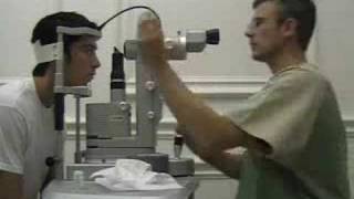 Laser Treatment for Vitreous Floaters  Patient Interview 3 [upl. by Junji411]