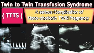 TTTS  Twin to Twin Transfusion Syndrome Ultrasound  A Serious COMPLICATION [upl. by Arlee]