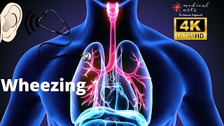 Lung Sounds  Expiratory WHEEZING Sound  Abnormal Breath Sounds  Adventitious Sounds [upl. by Olivia]