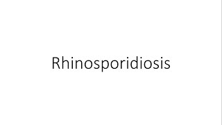 Rhinosporidiosis  ENT [upl. by Crissy]