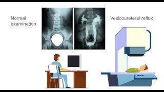 The CARE foundation  Ultrasound cystography [upl. by Oiled135]