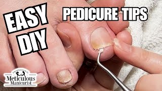 Beginner Pedicure Tutorial Clean Yellow Toenails at Home nails satisfying [upl. by Fernande]