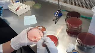 Stool Culture test procedure in Microbiology [upl. by Hebner633]