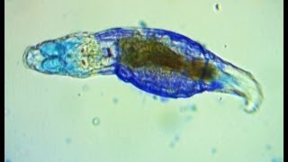 Observations of a bdelloid rotifer ending with full methylene blue reactiondeath [upl. by Kinzer981]