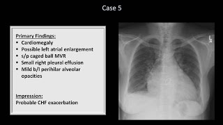 How to Interpret a Chest XRay Lesson 10  Self Assessment Part 1 [upl. by Luwana]