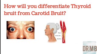 Difference between Thyroid Bruit and Carotid Bruit  How to differentiate Dr M B [upl. by Hegarty354]