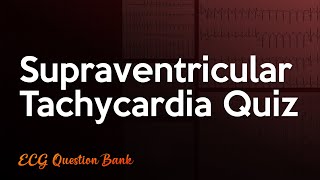 Supraventricular Tachycardia ECG Quiz [upl. by Nilac]