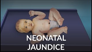 Neonatal Jaundice by L Veit  OPENPediatrics [upl. by Gilliam]