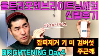 어드마이어마이스킨 DAY4 면봉 대신 씁니다 잡티제거 울트라포텐브라이트닝세럼  Admire my skin ultra potent brightening serum review [upl. by Sirama]