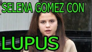 SELENA GOMEZ LUPUS  Selena Gomez ha diagnosticada Con Lupus [upl. by Naillimxam]