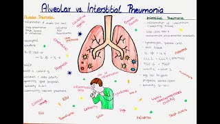 Alveolar vs Interstitial Pneumonia comparison [upl. by Gabriellia219]