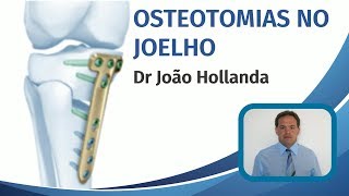 Osteotomia no joelho [upl. by Esalb]