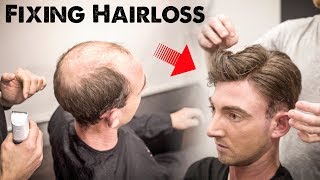 Mens Hairloss Treatment 20  Amazing Hairstyle Transformation  Does it Work  BluMaan 2018 [upl. by Yob]