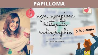 papilloma I oral pathology lectures [upl. by Elaina]