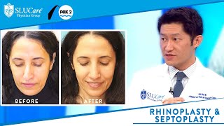 Rhinoplasty vs Septoplasty Better Breathing and Reshaping the Nose  Fox 2 [upl. by Eillac558]