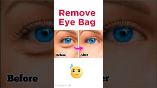 Remove Eye Bags in 2 Weeks  Effective Massage Plan eyebags viral shorts [upl. by Assilev]