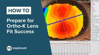 HowTo  Prepare for OrthoK lens fit success [upl. by Alyam]