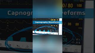 Mastering Waveform Capnography for ACLS Nursing Exams Emergency Medicine Skills norcet acls rrb [upl. by Barra]