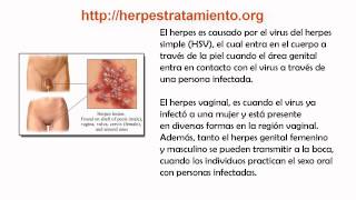 Herpes Vaginal [upl. by Brose]