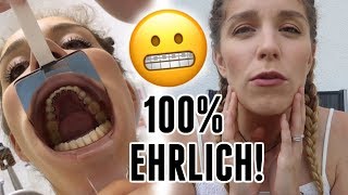 Barbaras Zahnspange wird eingesetzt  Arbeiten am Haus  Vlog 142 [upl. by Salb208]