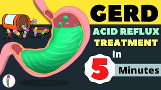 GERD Treatment  Acid Reflux Treatment  Heartburn Treatment  All You Need to Know [upl. by Atilamrac]