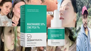 Dermatouch Niacinamide Serum  Honest Review [upl. by Ninehc]