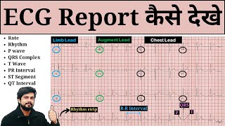 How to Read ECG  ECG Report Kaise Dekhe  ECG Report Kaise Check Kare  Normal amp Abnormal [upl. by Yensehc]