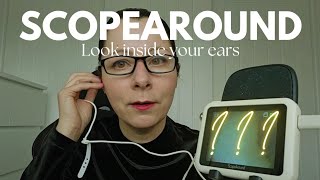 ScopeAround Otoscope Ear Camera See whats inside my ears [upl. by Esnahc]