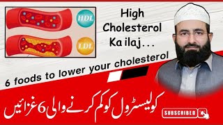 High Cholesterol ka Ilaj In UrduHindi l High CholesterolLDL Symptoms Causes and Treatment [upl. by Asiaj]