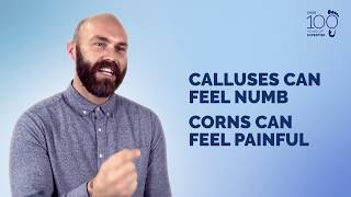 Understand and Manage Corns amp Calluses [upl. by Airuam]