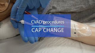 CVAD procedures Cap change  AboutKidsHealth at The Hospital for Sick Children [upl. by Etan]