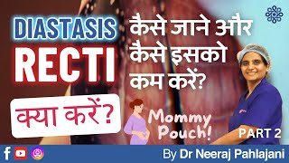 प्रेग्नन्सी के बाद पेट निकला हुआ How to detect amp avoid Diastasis Recti Prt 2  Dr Neeraj Pahlajani [upl. by Macfadyn868]