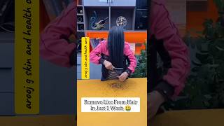 How Lice Remove at Home RemediesRemove Lice From Hair shorts haircare liceremoval youtubeshorts [upl. by Colson]