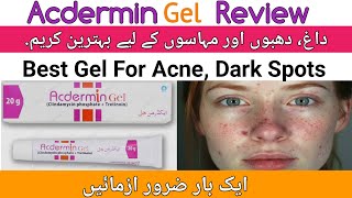 Acdermin Gel Review  Acne gel  Acne Cream Acne treatment  Dr Ahmed Bukhari [upl. by Lossa]