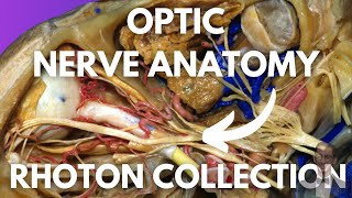 Optic Nerve Neuroanatomy Simplified Rhoton Collection [upl. by Ernaldus]