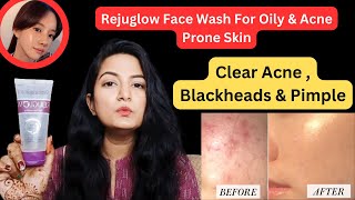 HONEST REVIEW  Rejuglow Facewash For Acne Blackheads Pimples  Salicylic Acid amp Glycolic Acid [upl. by Yewed636]