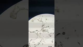 Zooplankton found in pond water biology microscopevideo [upl. by Gayel]