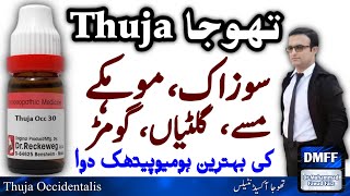 Thuja Homeopathic Medicine  thuja 200 homeopathic medicine uses in hindi  thuja 30 uses  Thuja Q [upl. by Galang]