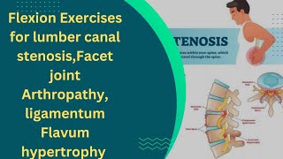 Flexion Exercises For lumber Canal stenosisFacet Joint Arthropathy ligamentum Flavum Hypertrophy [upl. by Enomal889]