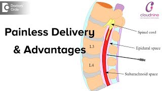 What is Painless Delivery Is epidural given during normal deliveryDrVanita Mande of C9 Hospitals [upl. by Irakab295]