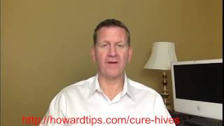 How To Cure Hives At Home  Home Remedies For Hives [upl. by Ilrebmik]