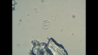 The vortex animal vorticella under the microscope  1000x magnification [upl. by Akin]