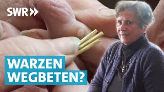 Warzen entfernen – Was hilft wirklich [upl. by Assiralk]