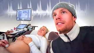 VOOR HET EERST NAAR DE HARTSLAG LUISTEREN👶🏼  baby vlog 3 [upl. by Oecam66]