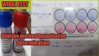 Widal Dilution test  Quantitative Widal test by slide method  Typhoid test करना सीखे [upl. by Aridan]