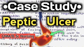 Case StudyPresentation on Peptic Ulcer nursingcriteria pepticulcer ncp [upl. by Saxe]